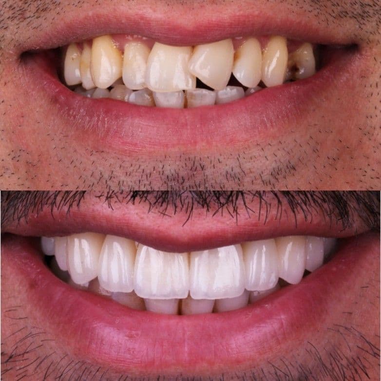 Case Study 1 – Before & After