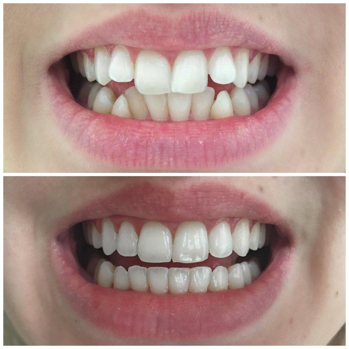 Case Study 2 – Before & After