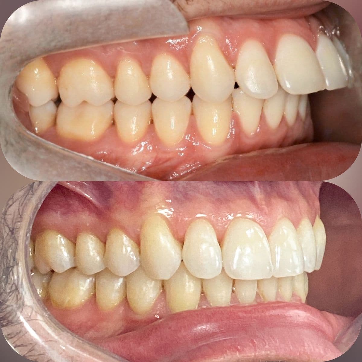 Case Study 3 – Before & After